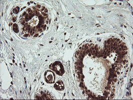 TRMT2A Antibody in Immunohistochemistry (Paraffin) (IHC (P))