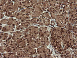 TRMT2A Antibody in Immunohistochemistry (Paraffin) (IHC (P))