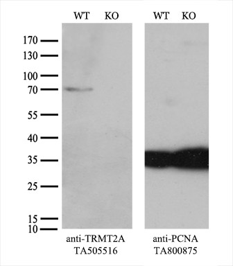 TRMT2A Antibody