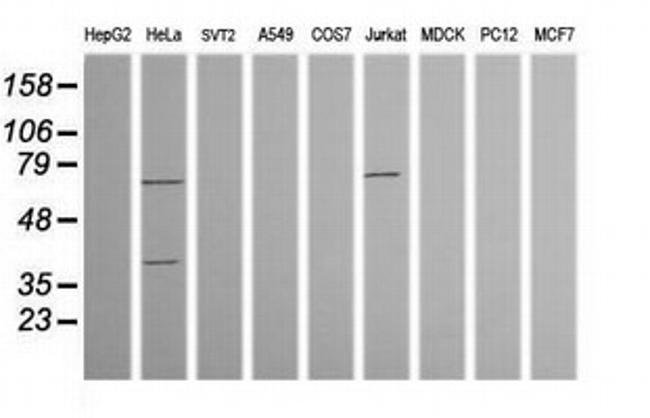 TRMT2A Antibody in Western Blot (WB)