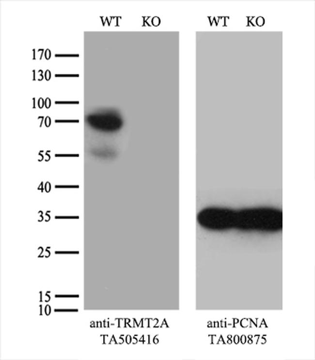 TRMT2A Antibody in Western Blot (WB)