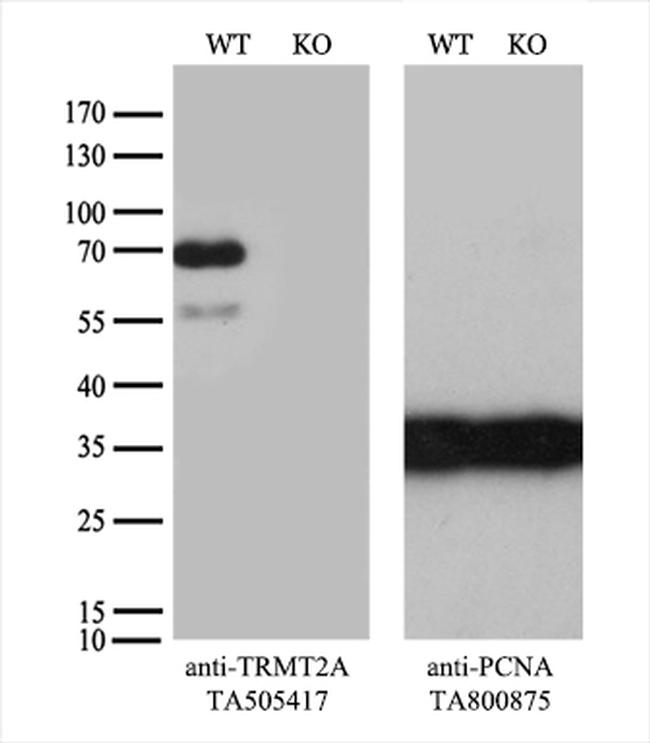 TRMT2A Antibody in Western Blot (WB)