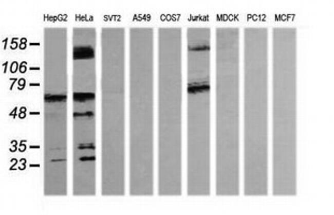 TRMT2A Antibody in Western Blot (WB)