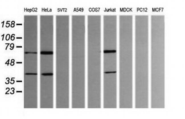 TRMT2A Antibody in Western Blot (WB)