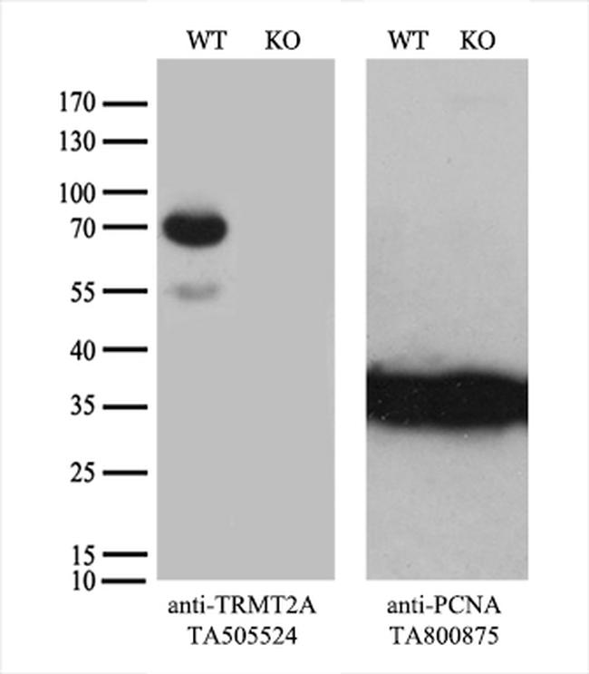 TRMT2A Antibody in Western Blot (WB)