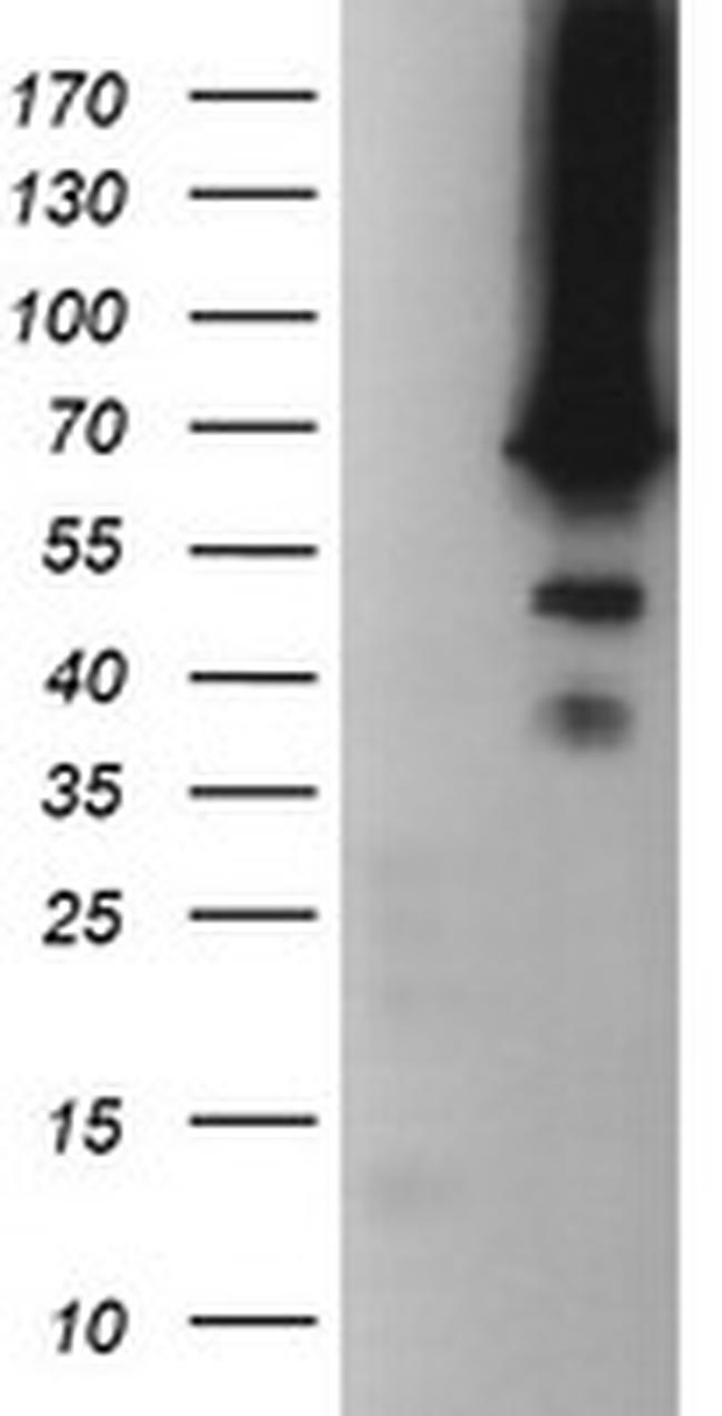 TRMT2A Antibody in Western Blot (WB)