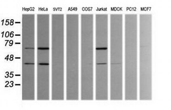 TRMT2A Antibody in Western Blot (WB)