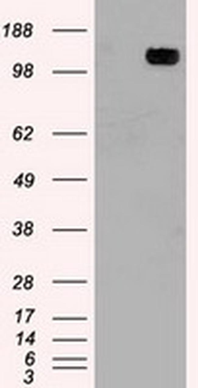 TRPM4 Antibody in Western Blot (WB)