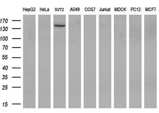 TRPM4 Antibody in Western Blot (WB)