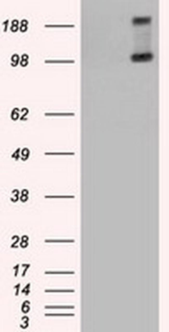 TRPM4 Antibody in Western Blot (WB)