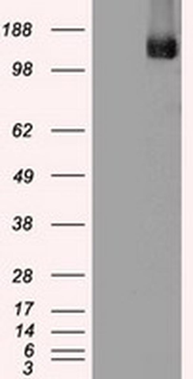 TRPM4 Antibody in Western Blot (WB)