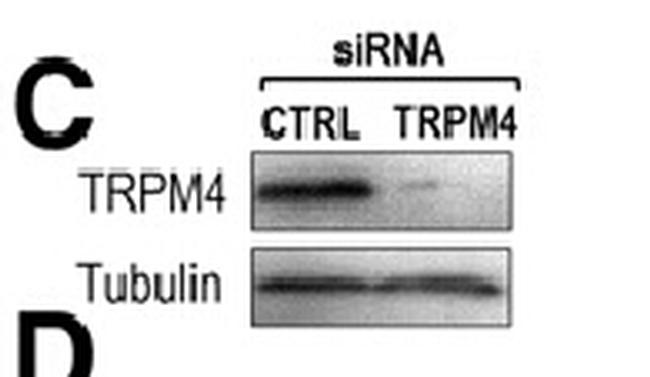 TRPM4 Antibody in Western Blot (WB)