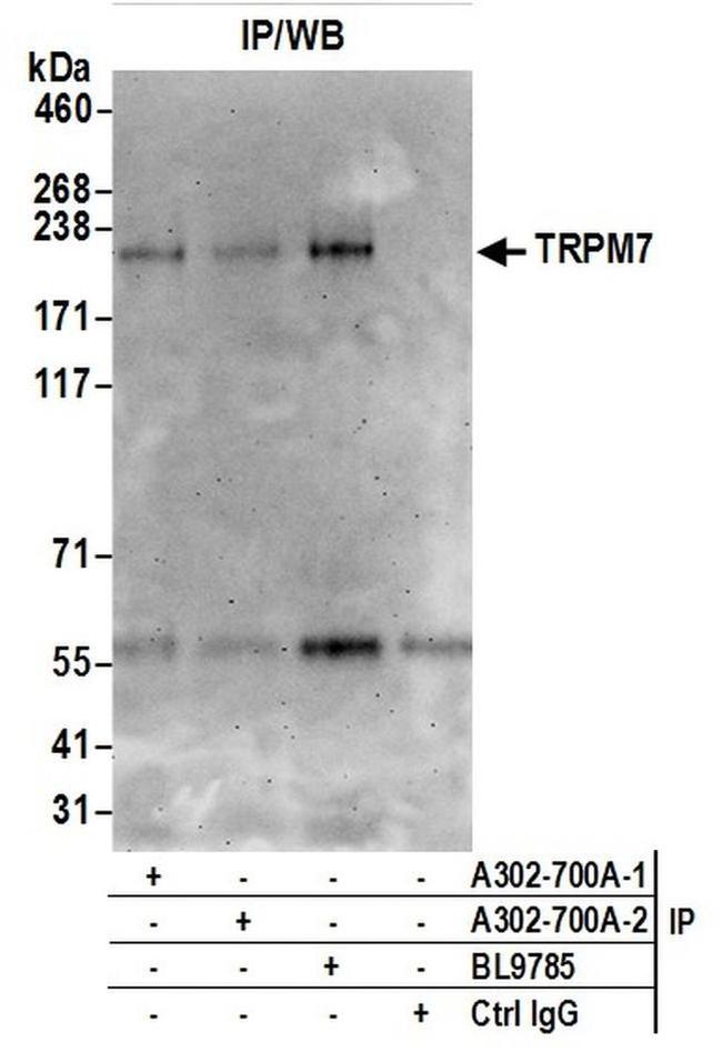 TRPM7 Antibody in Western Blot (WB)