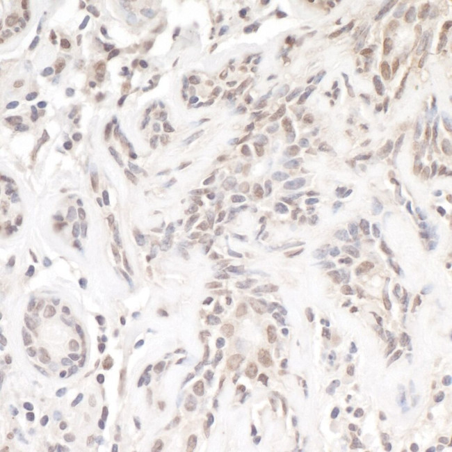 TReP-132/TRERF1 Antibody in Immunohistochemistry (IHC)