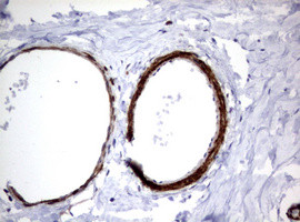 TSC1 Antibody in Immunohistochemistry (Paraffin) (IHC (P))