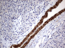 TSC1 Antibody in Immunohistochemistry (Paraffin) (IHC (P))