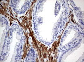 TSC1 Antibody in Immunohistochemistry (Paraffin) (IHC (P))