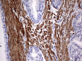 TSC1 Antibody in Immunohistochemistry (Paraffin) (IHC (P))