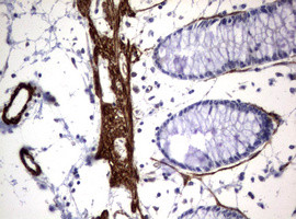 TSC1 Antibody in Immunohistochemistry (Paraffin) (IHC (P))