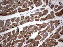 TSC1 Antibody in Immunohistochemistry (Paraffin) (IHC (P))