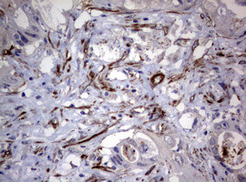 TSC1 Antibody in Immunohistochemistry (Paraffin) (IHC (P))