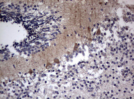 TSC1 Antibody in Immunohistochemistry (Paraffin) (IHC (P))