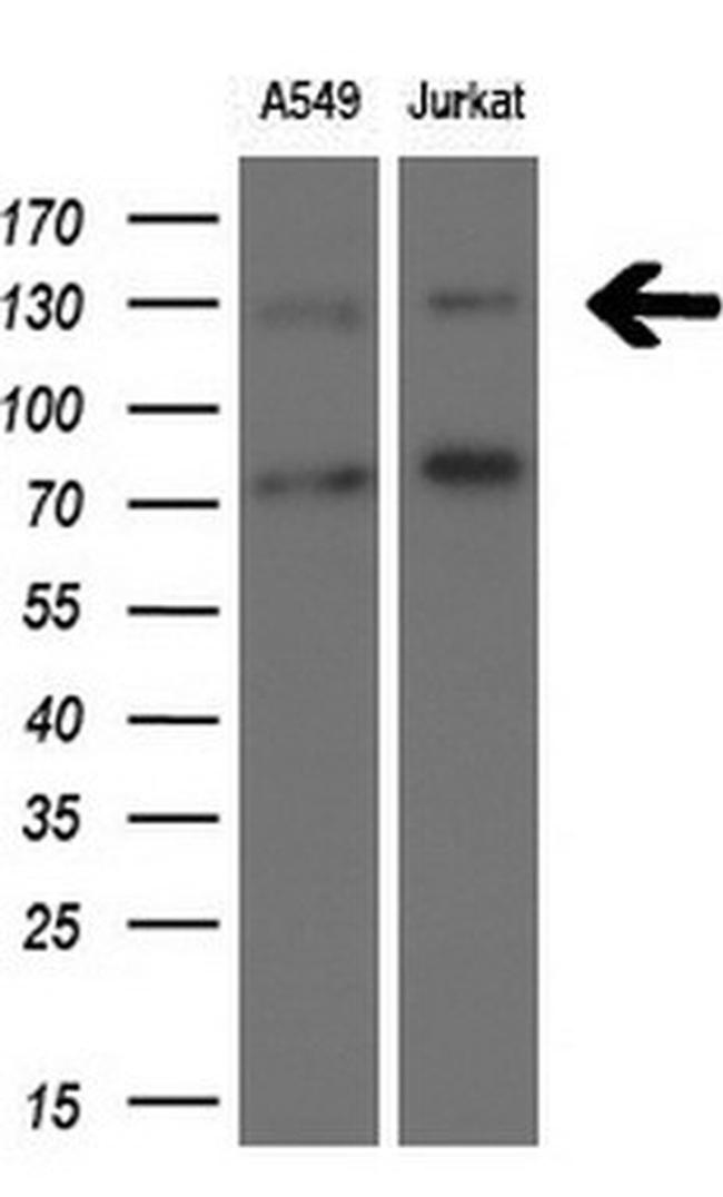 TSC1 Antibody in Western Blot (WB)