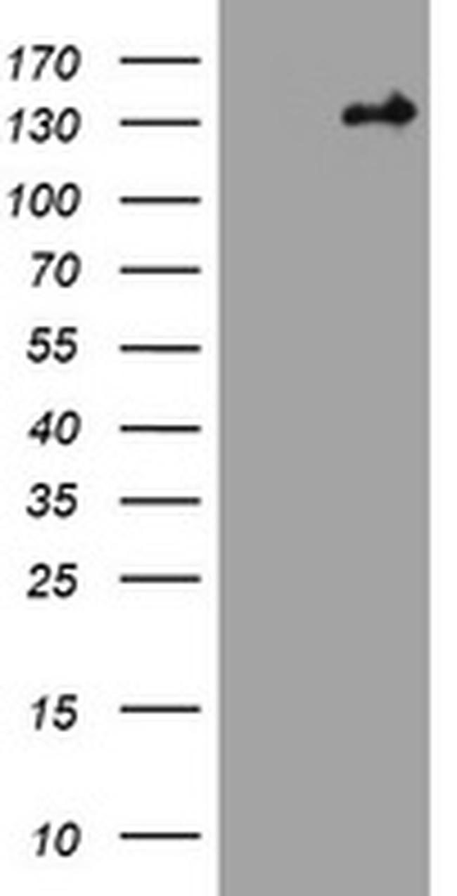 TSC1 Antibody in Western Blot (WB)