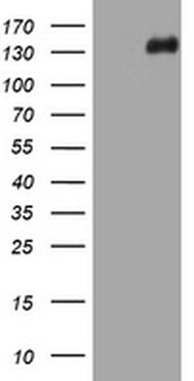 TSC1 Antibody in Western Blot (WB)