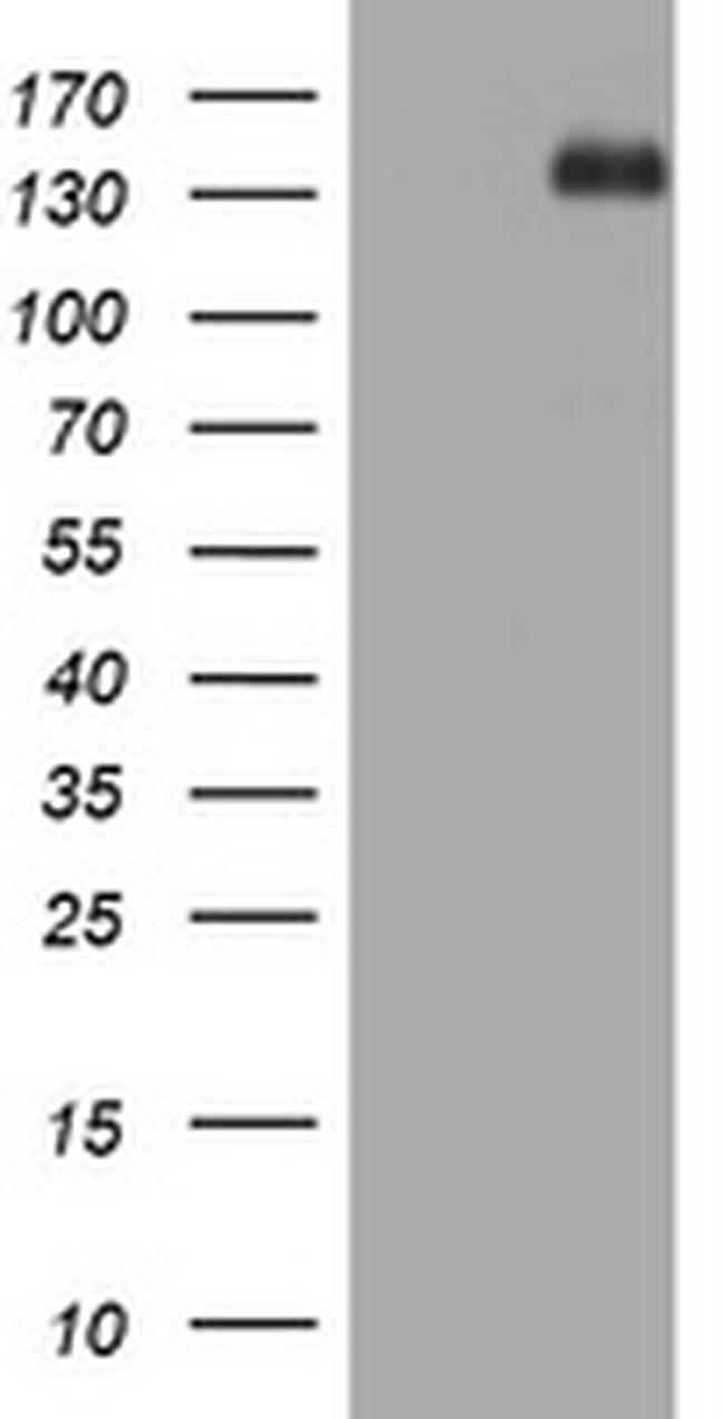 TSC1 Antibody in Western Blot (WB)