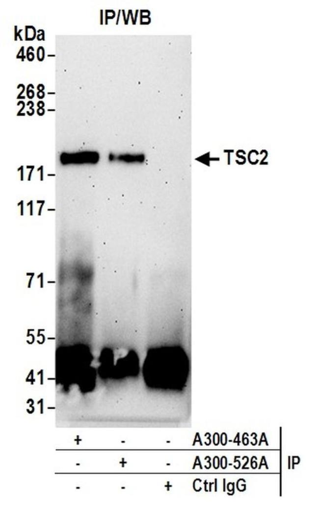 TSC2 Antibody in Immunoprecipitation (IP)