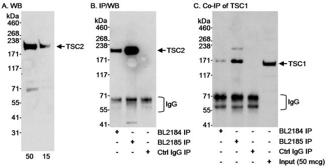 TSC2 Antibody in Western Blot (WB)