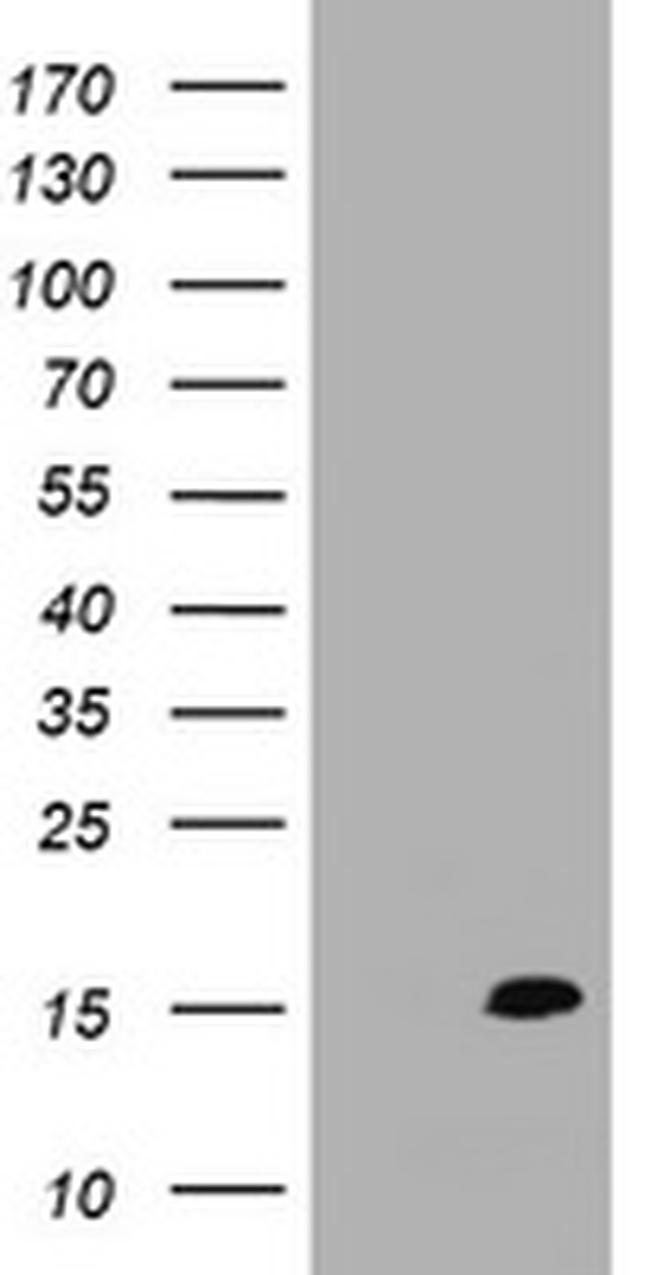 TSC22D3 Antibody in Western Blot (WB)