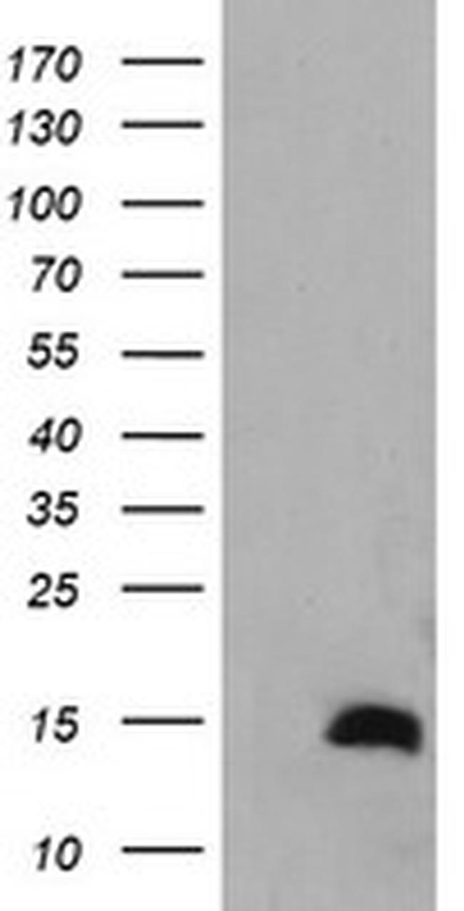 TSC22D3 Antibody in Western Blot (WB)