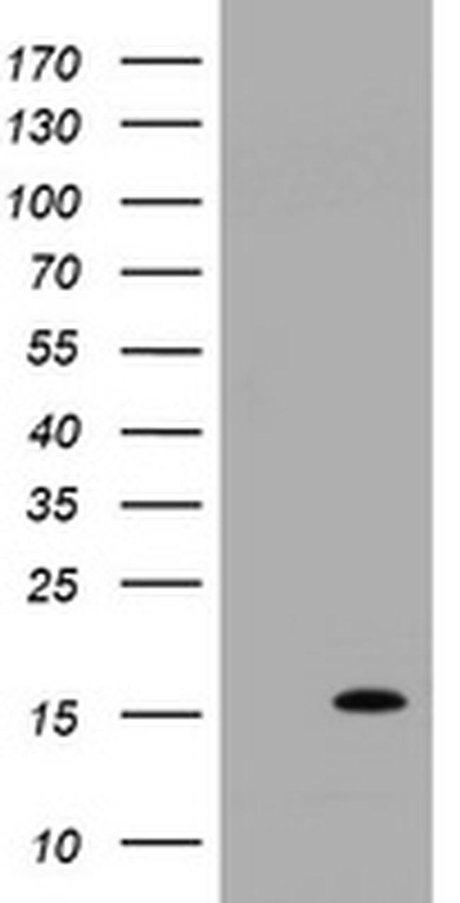 TSC22D3 Antibody in Western Blot (WB)