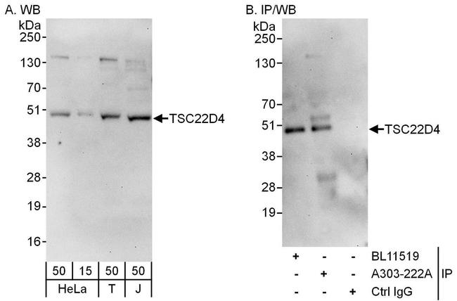 TSC22D4 Antibody in Western Blot (WB)