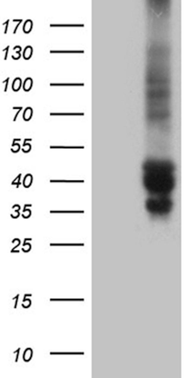 TSC22D4 Antibody in Western Blot (WB)