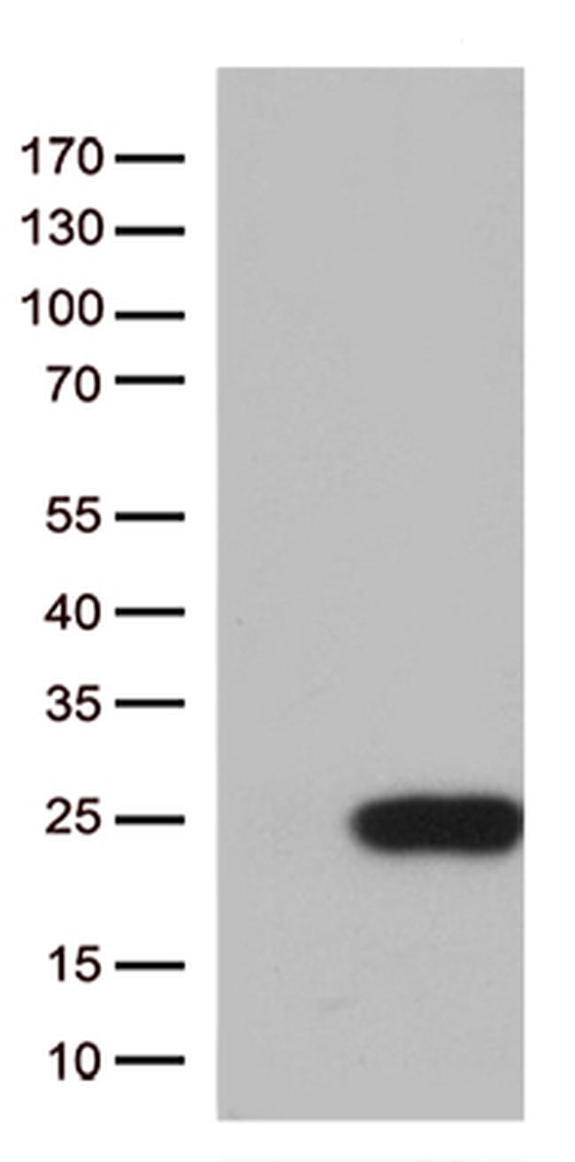 TSEN15 Antibody in Western Blot (WB)