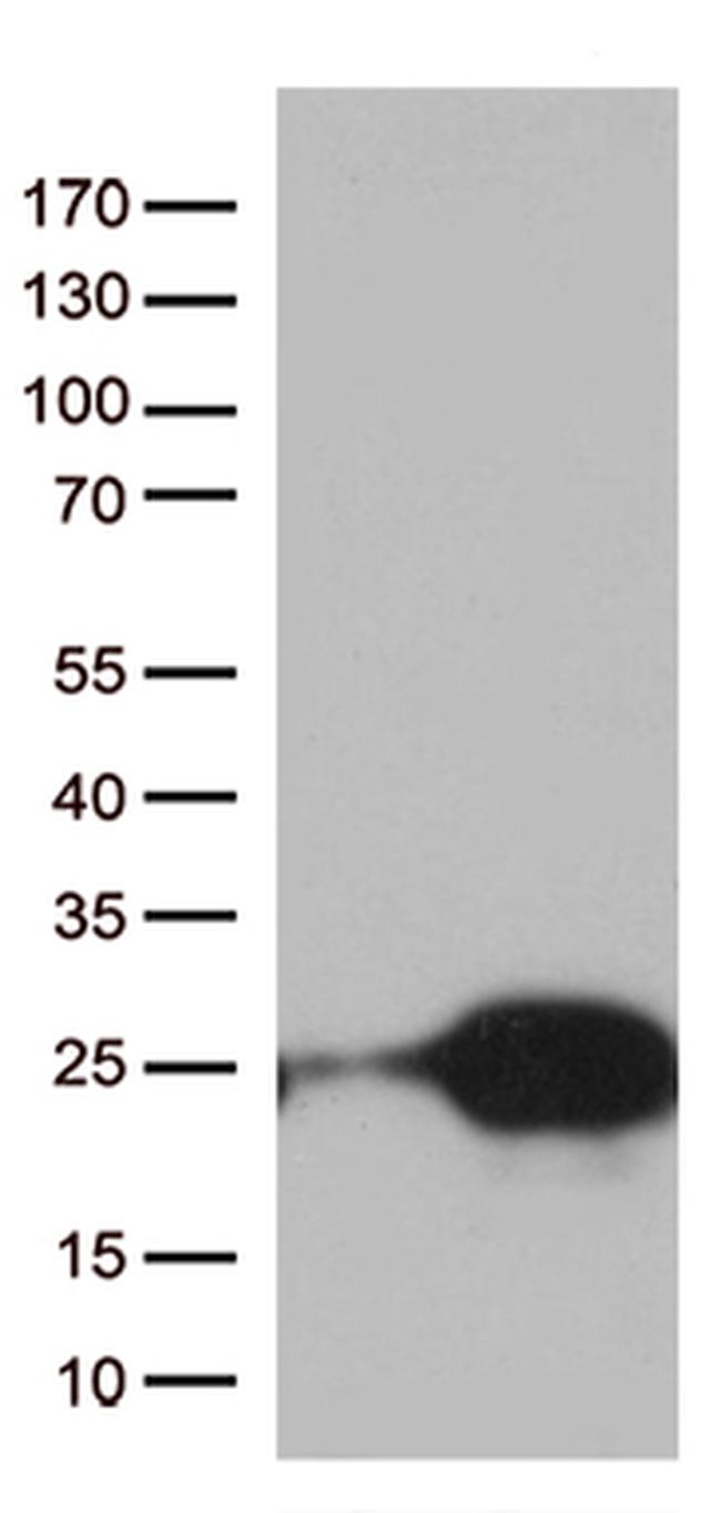 TSEN15 Antibody in Western Blot (WB)