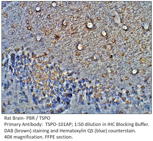 PBR Antibody in Immunohistochemistry (IHC)
