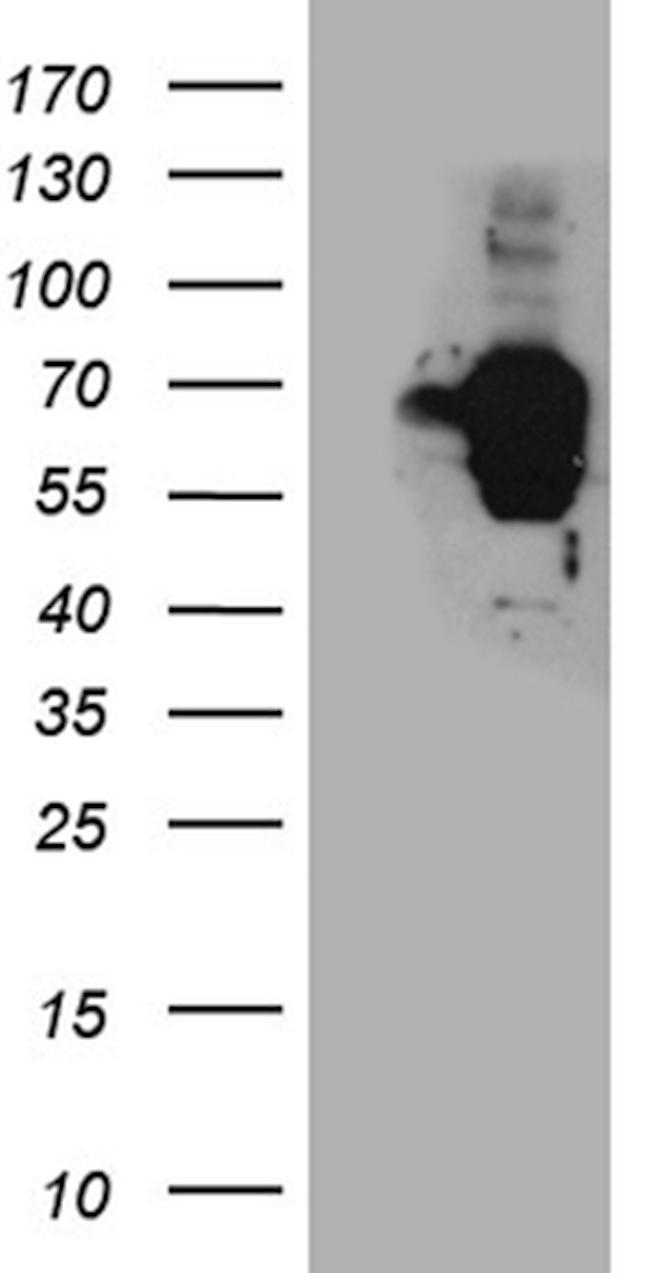 TSPYL1 Antibody in Western Blot (WB)