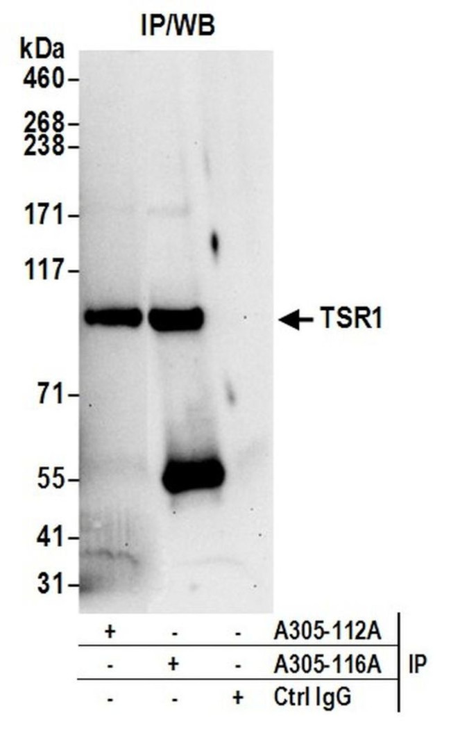 TSR1 Antibody in Immunoprecipitation (IP)