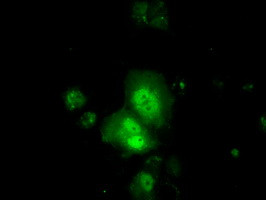 TTC32 Antibody in Immunocytochemistry (ICC/IF)