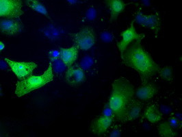 TTC32 Antibody in Immunocytochemistry (ICC/IF)