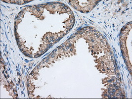 TTC32 Antibody in Immunohistochemistry (Paraffin) (IHC (P))