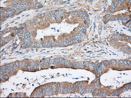 TTC32 Antibody in Immunohistochemistry (Paraffin) (IHC (P))