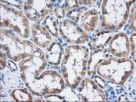 TTC32 Antibody in Immunohistochemistry (Paraffin) (IHC (P))