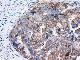 TTC32 Antibody in Immunohistochemistry (Paraffin) (IHC (P))