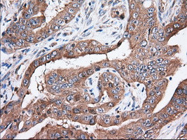 TTC32 Antibody in Immunohistochemistry (Paraffin) (IHC (P))