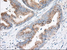 TTC32 Antibody in Immunohistochemistry (Paraffin) (IHC (P))